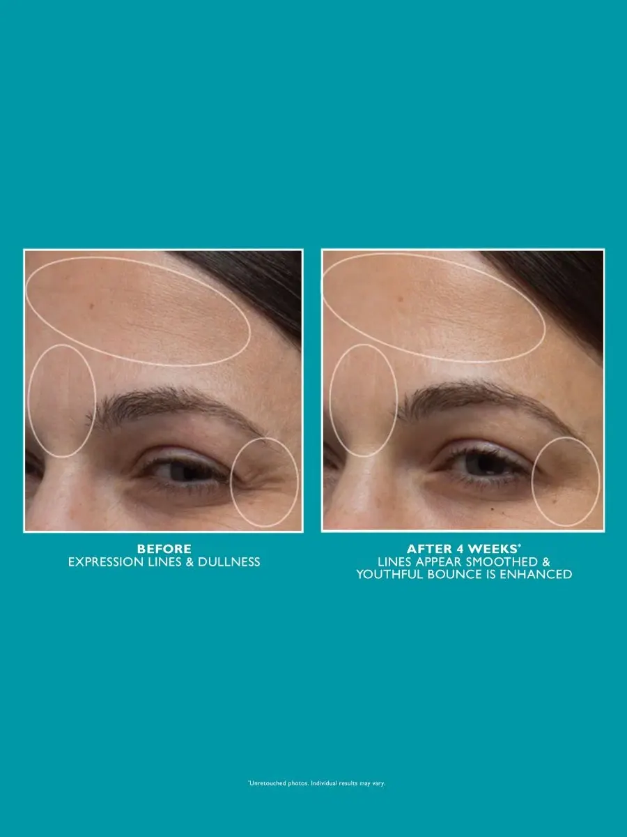 Увлажняющий крем для лица Peptide Skinjection Peter Thomas Roth, 50 мл — изображение 6 из 7