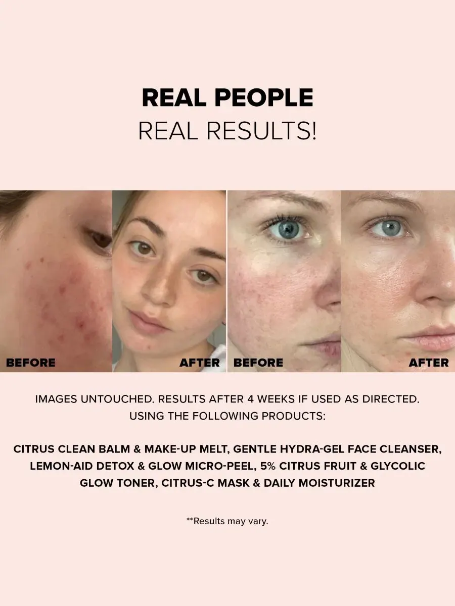 Увлажняющий крем-маска для лица Citrus-C Mask & Daily Moisturizer, 60 мл NUDESTIX — изображение 3 из 9