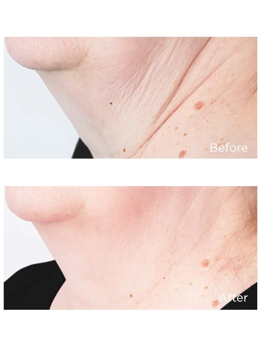 Крем для шеи и подбородка Cold Plasma Plus+ Sub-D/Neck, 59 мл Perricone MD — изображение 4 из 7