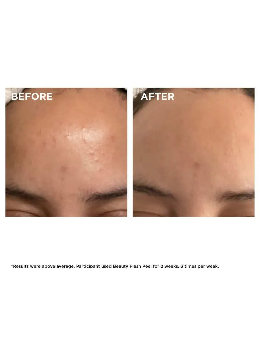 Пилинг Clarins — Экспресс- Beauty Flash Peel с BHA и AHA кислотами — изображение 3 из 7