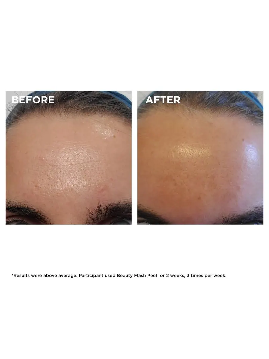 Пилинг Clarins — Экспресс- Beauty Flash Peel с BHA и AHA кислотами — изображение 7 из 7