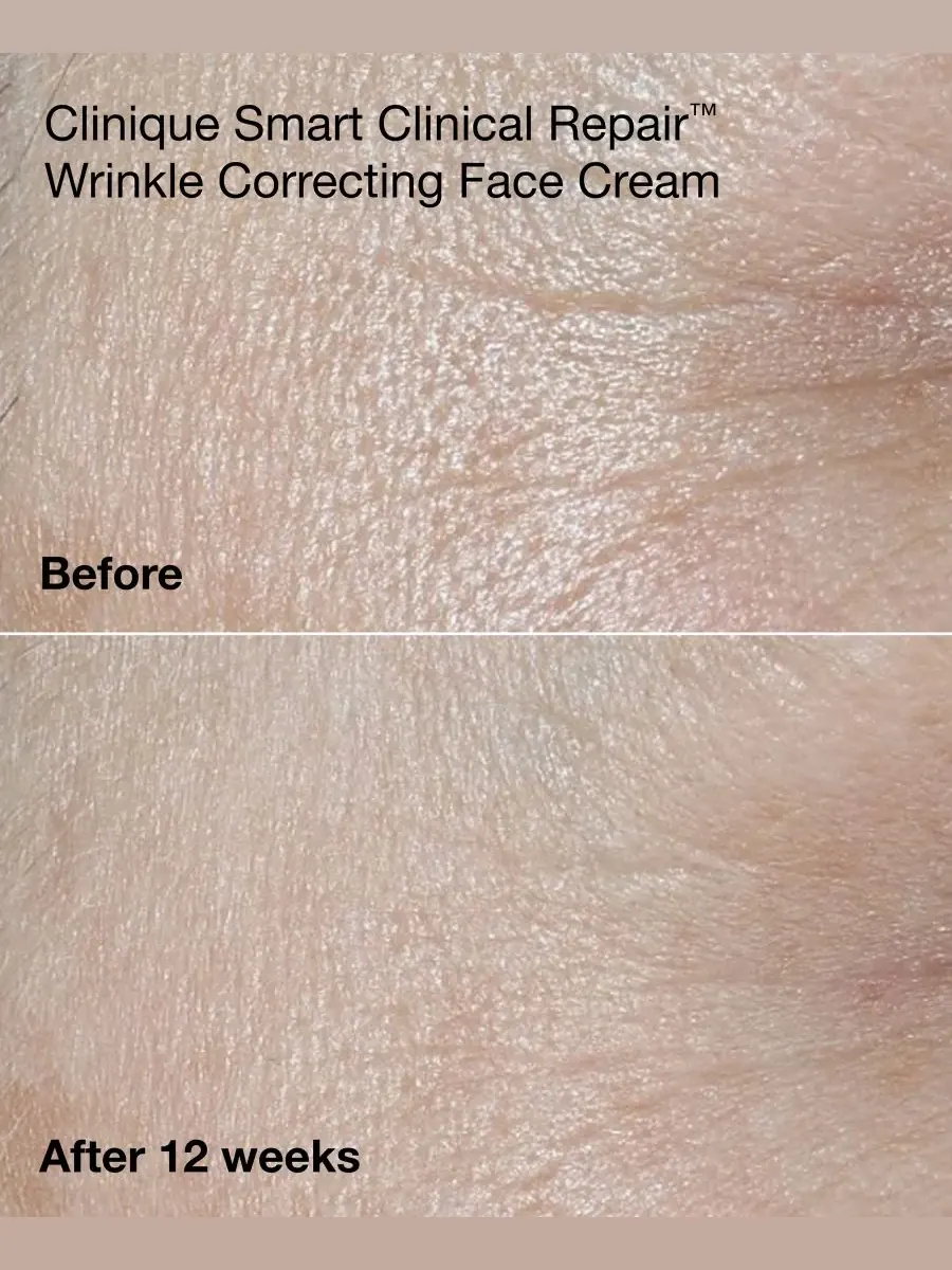 Clinique Мини-набор для ухода за кожей Smart Clinical Repair из 3 предметов — изображение 4 из 8