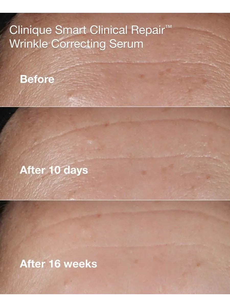 Clinique Мини-набор для ухода за кожей Smart Clinical Repair из 3 предметов — изображение 6 из 8