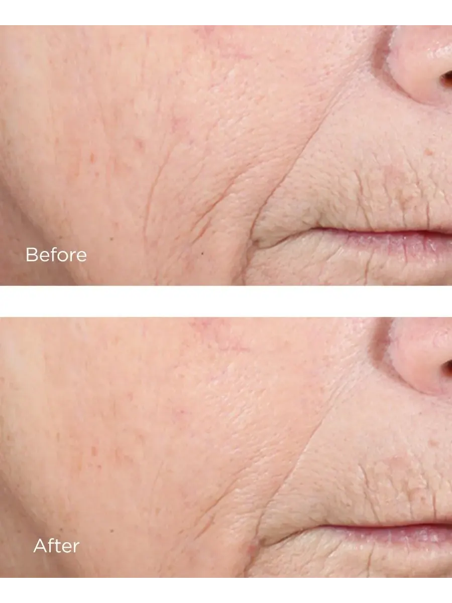 Сыворотка Perricone Md — Комплекс для осветления кожи с эфиром витамина С CCC+ и феруловой кислотой — изображение 2 из 3