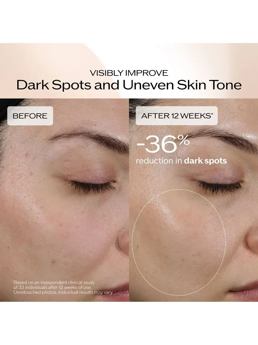 Сыворотка Shiseido — Для разглаживания темных пятен и морщин Benefiance, 45 мл — изображение 4 из 7