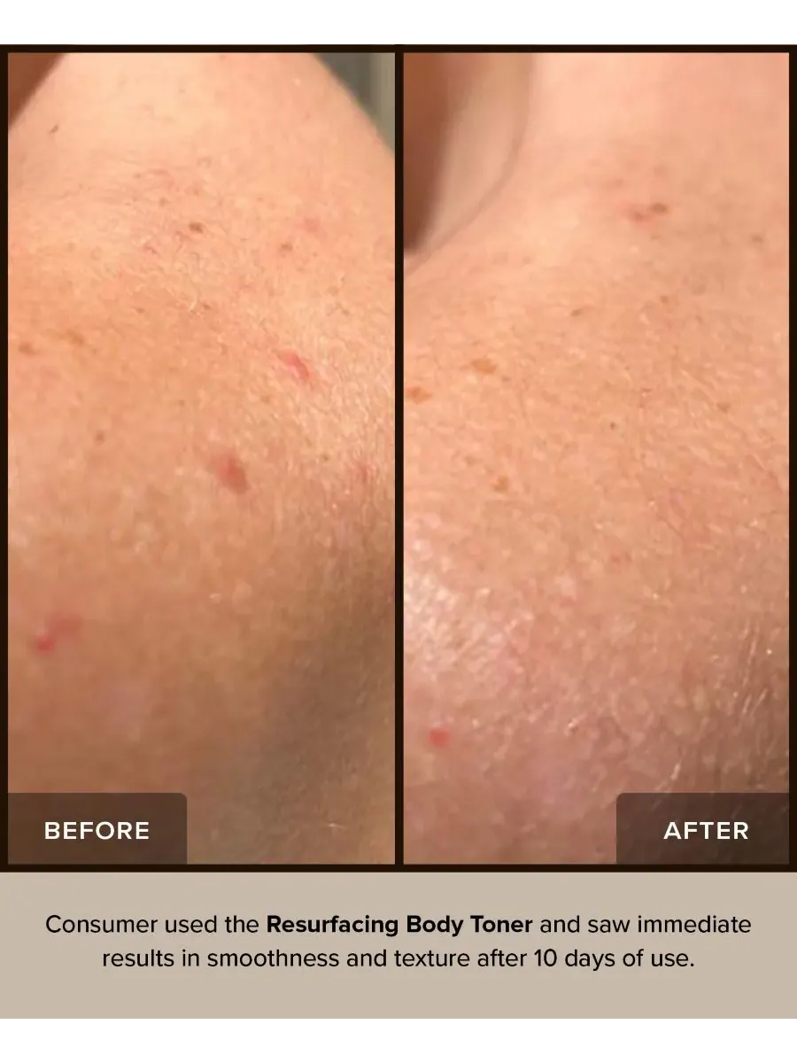 Тоник Nudestix — Для тела NUDEBODY Resurfacing Body Toner — изображение 5 из 9