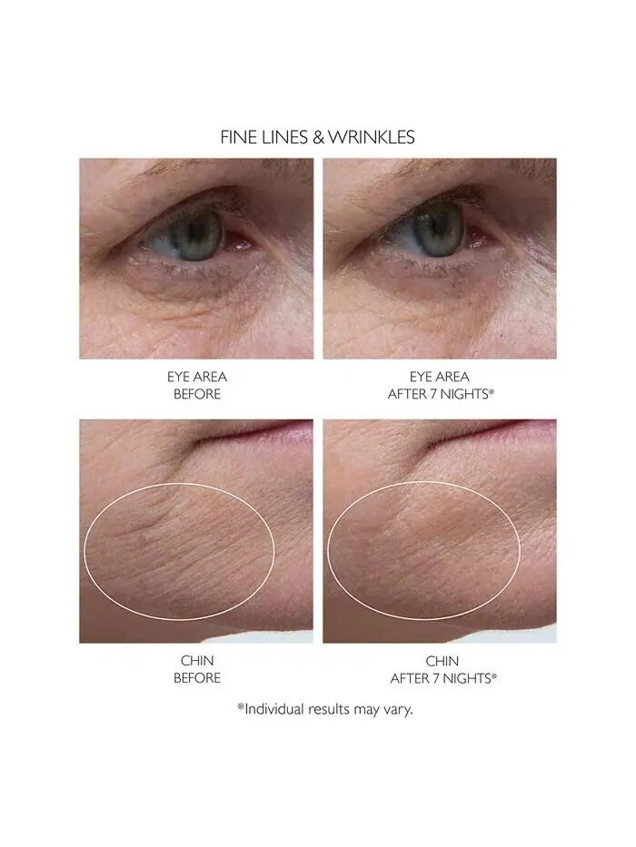Сыворотка Peter Thomas Roth — Ночная Retinol Fusion PM, ,0 жидк. унция — изображение 3 из 5
