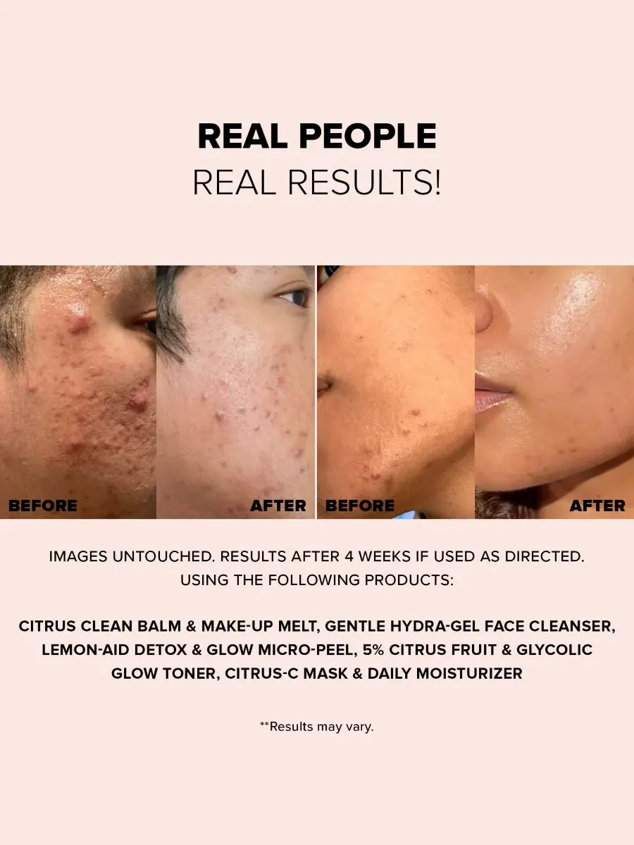 NUDESTIX Набор для обновления кожи Nudeskin Citrus Skin Renewal Set из 3 предметов — изображение 3 из 9
