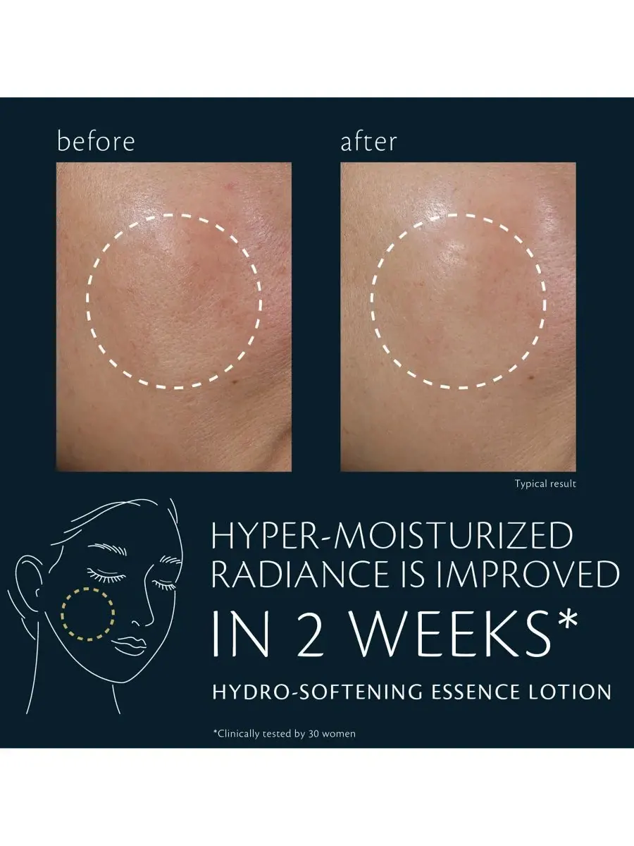 Clé de Peau Beauté Сменный блок гидросмягчающего эссенциального лосьона, 5,7 унций — изображение 5 из 10
