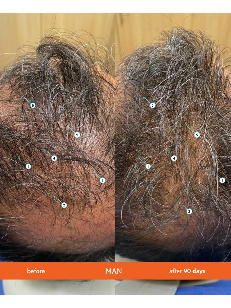 Набор из 2 предметов: шампунь и кондиционер Revita High-Performance Hair Density (большой комплект) — изображение 7 из 10