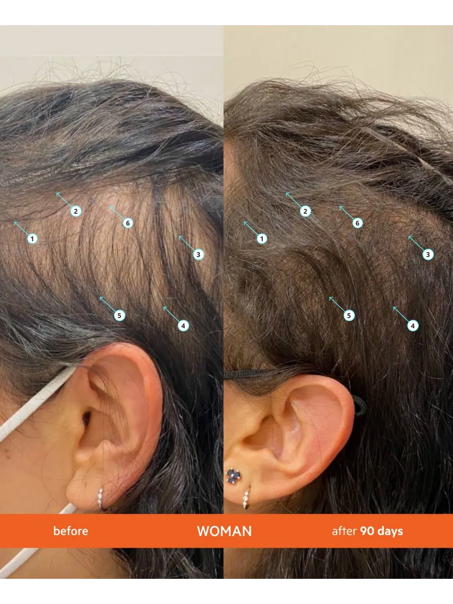 Набор из 2 предметов: шампунь и кондиционер Revita High-Performance Hair Density (большой комплект) — изображение 8 из 10