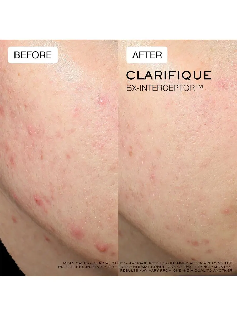 Сыворотка против акне Clarifique Bx-Interceptor Acne Treatment, 30 мл Lancôme — изображение 11 из 11