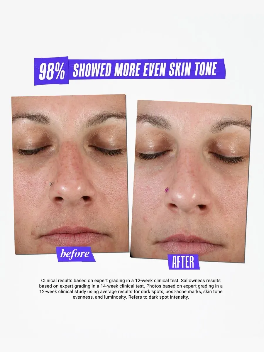 Сыворотка Kiehl's — Since 1851 Средство от пигментных пятен Dermatologist Solutions Clearly — изображение 8 из 10