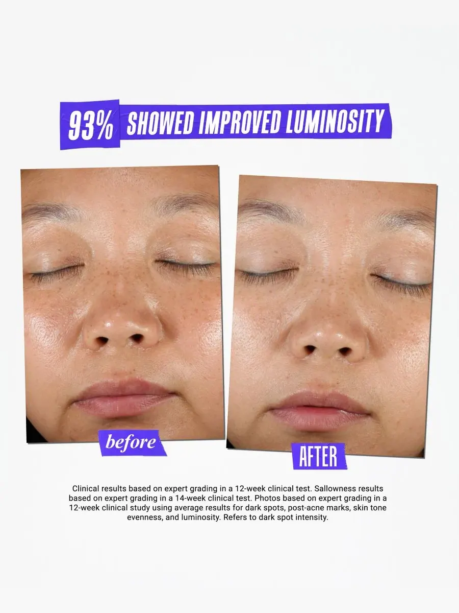 Сыворотка Kiehl's — Since 1851 Средство от пигментных пятен Dermatologist Solutions Clearly — изображение 9 из 10