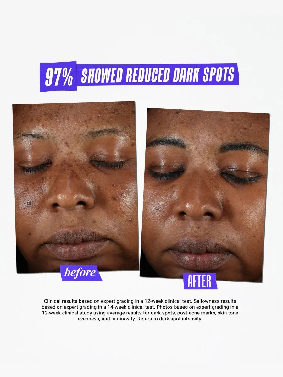 Сыворотка Kiehl's — Since 1851 Средство от пигментных пятен Dermatologist Solutions Clearly — изображение 10 из 10