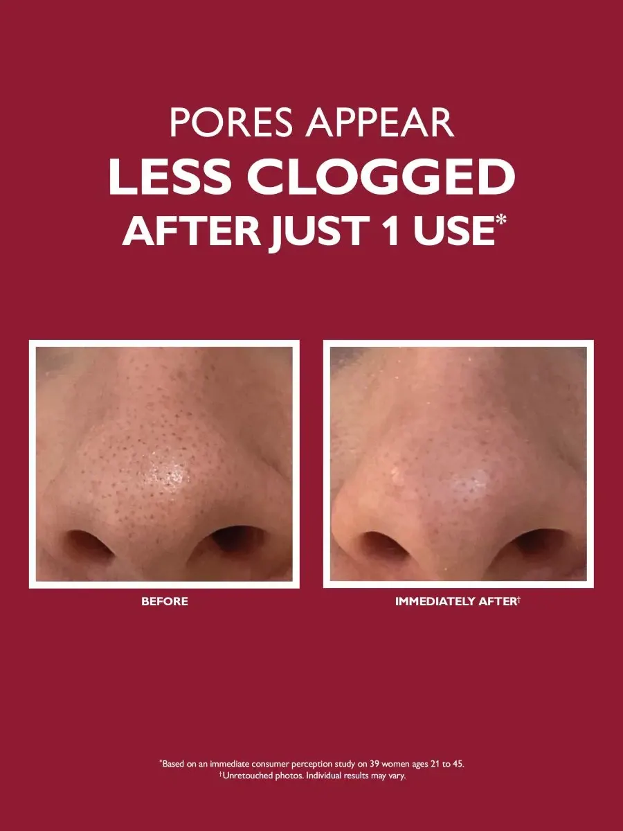 Крем для лица Peter Thomas Roth — Очищающее средство для микродермабразии Even Smoother — изображение 2 из 5