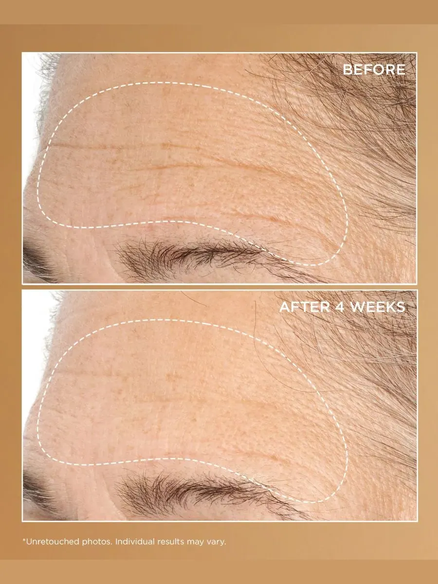 Сыворотка Perricone Md — Для глубокого разглаживания морщин Neuropeptide Deep Crease Serum — изображение 4 из 4