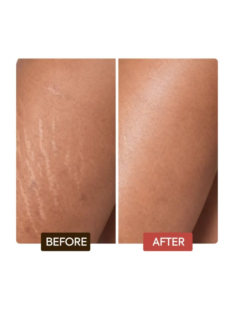 Омолаживающий лосьон для тела Naturalle Intense Extreme Glow - 17,6 унций Makari — изображение 8 из 8