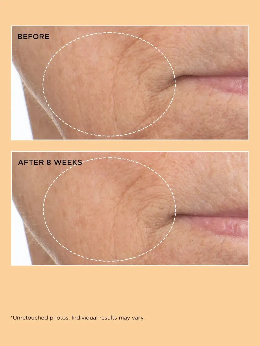 Сыворотка для лица укрепляющая Neuropeptide Firming Facial Concentrate, 60 мл Perricone MD — изображение 4 из 5