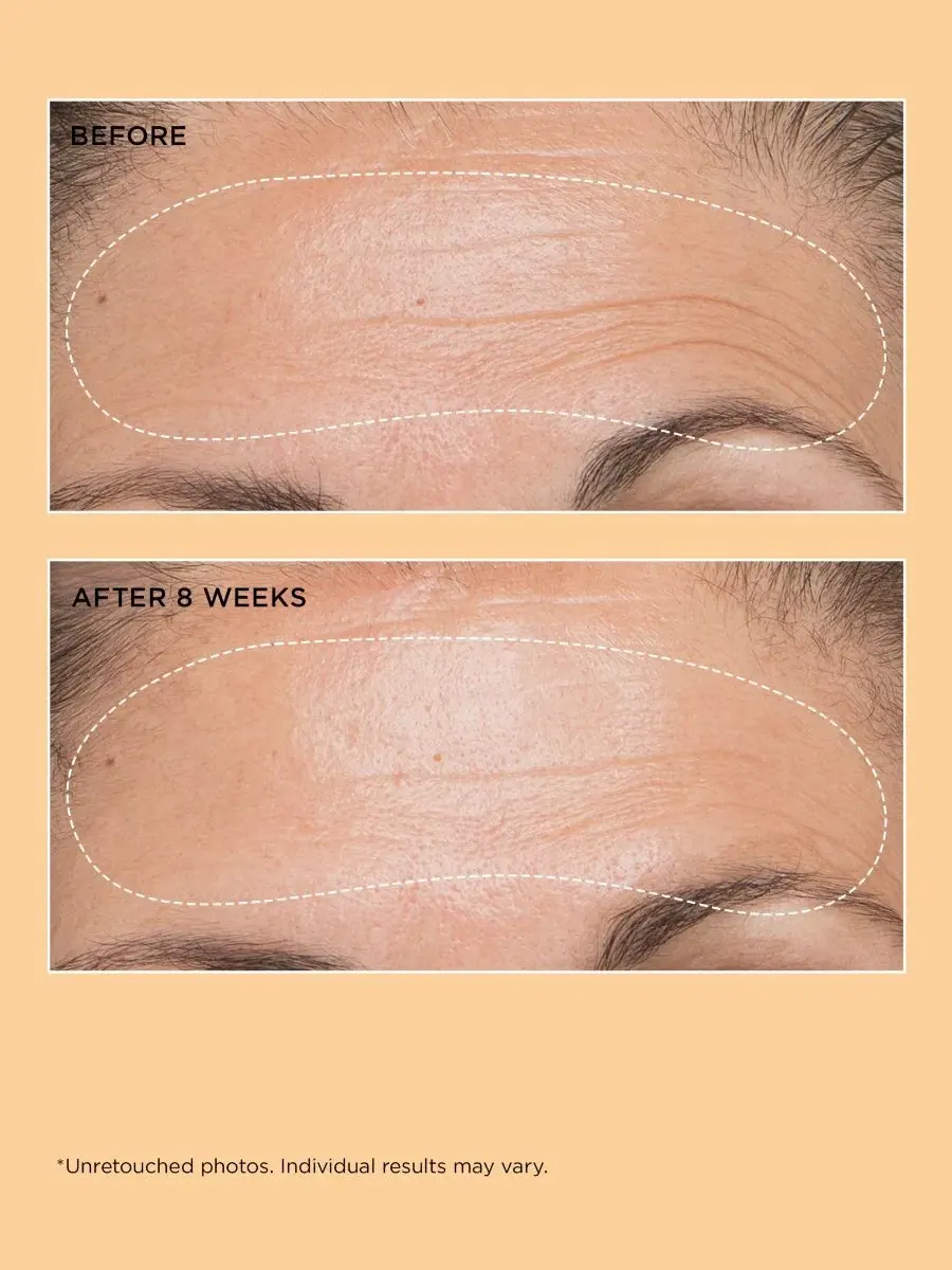 Сыворотка для лица укрепляющая Neuropeptide Firming Facial Concentrate, 60 мл Perricone MD — изображение 5 из 5