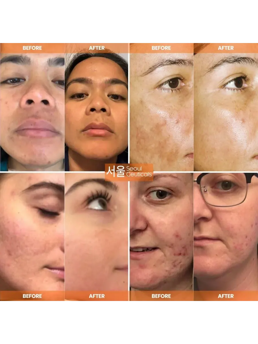 Сыворотка Seoul Ceuticals — Корейская для ухода за кожей с витамином С, дневная для сияния кожи — изображение 3 из 10