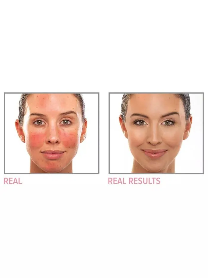 Крем-корректор цвета Bye Bye Redness, нейтрализующий покраснения It Cosmetics — изображение 2 из 4