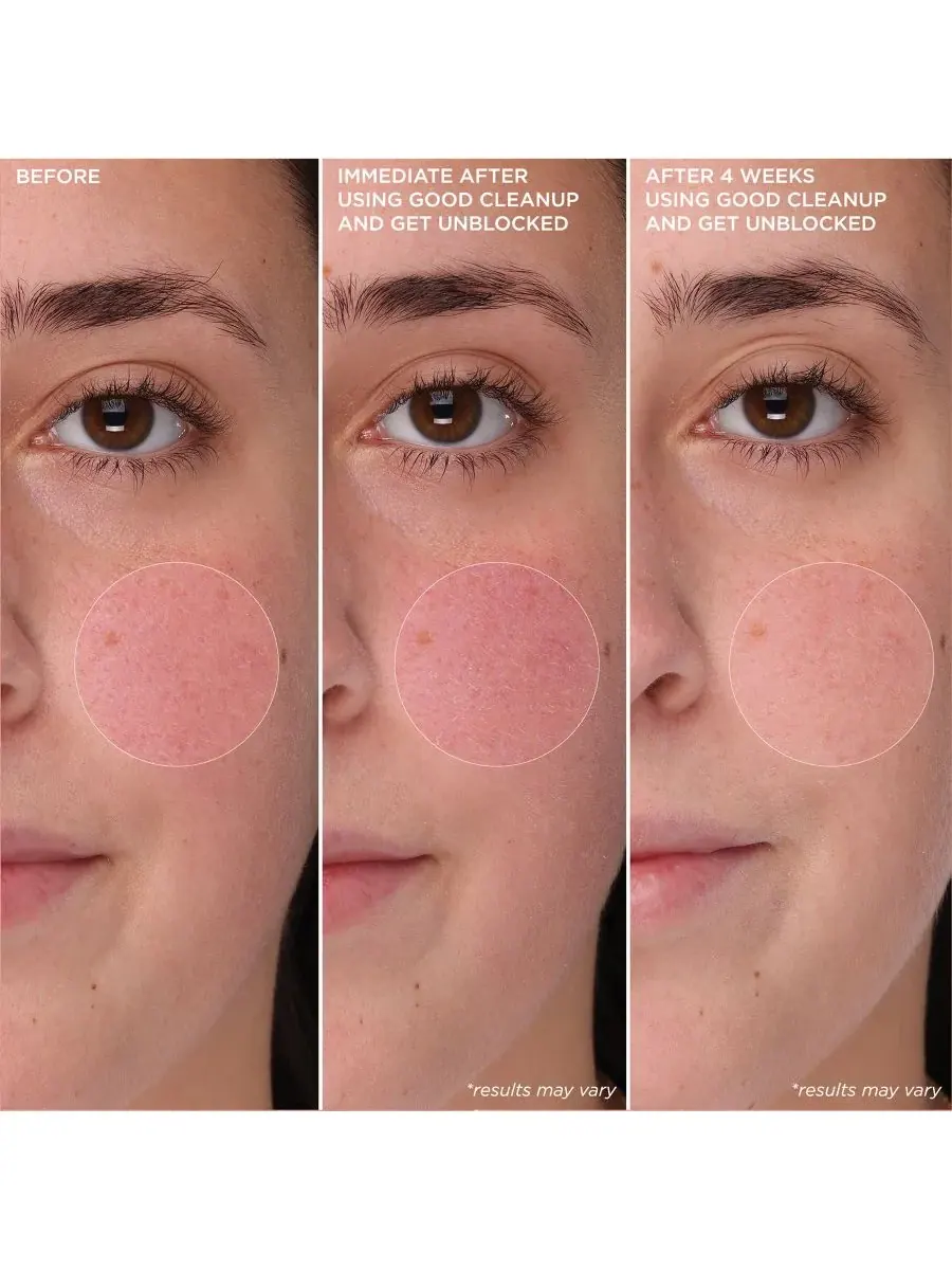 Гель для умывания Benefit Cosmetics — Пенящееся очищающее средство для очищения пор POREfessional — изображение 3 из 10