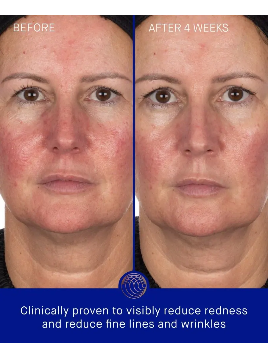 Augustinus Bader Гидрогелевые маски для лица, набор из 3 штук — изображение 4 из 4