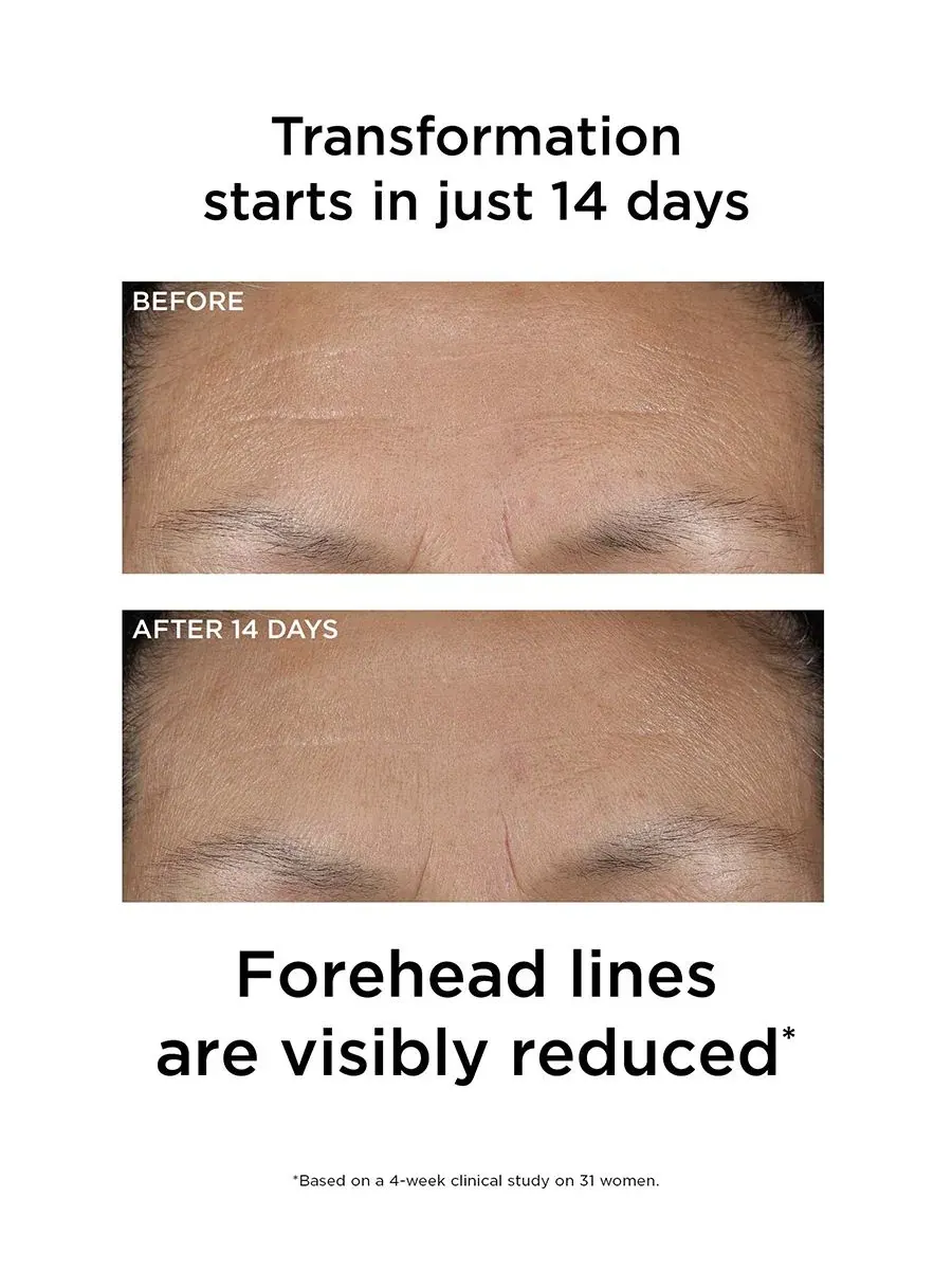 Сыворотка Elizabeth Arden — Для лица PREVAGE -в-1 Reset Serum, 30 мл — изображение 8 из 10
