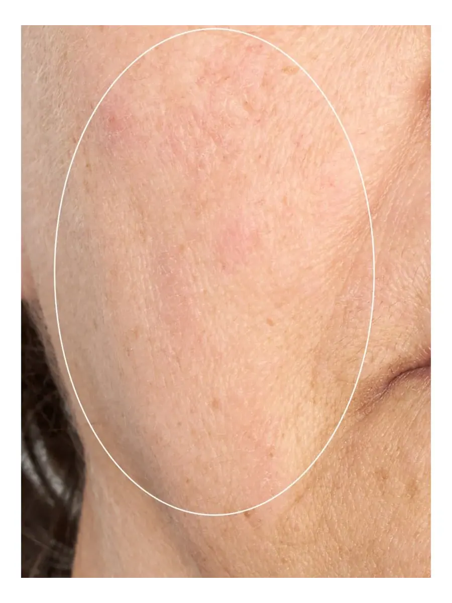 Сыворотка Perricone Md — Интенсивная разглаживающая HP, 57 г — изображение 5 из 7