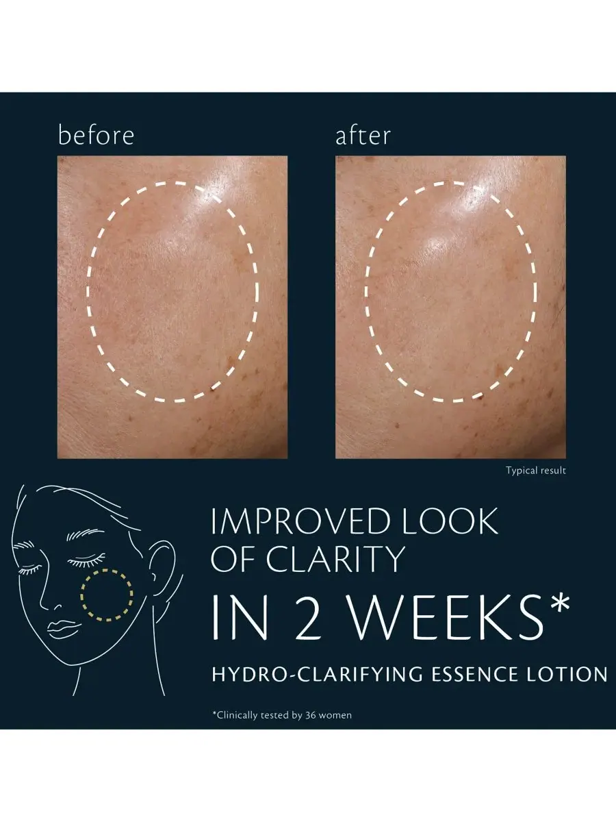 Clé de Peau Beauté Очищающий гидролосьон, 170 мл — изображение 5 из 8
