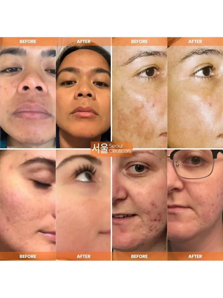 Сыворотка Seoul Ceuticals — Корейская для ухода за кожей с витамином С, дневная для сияния кожи — изображение 3 из 9