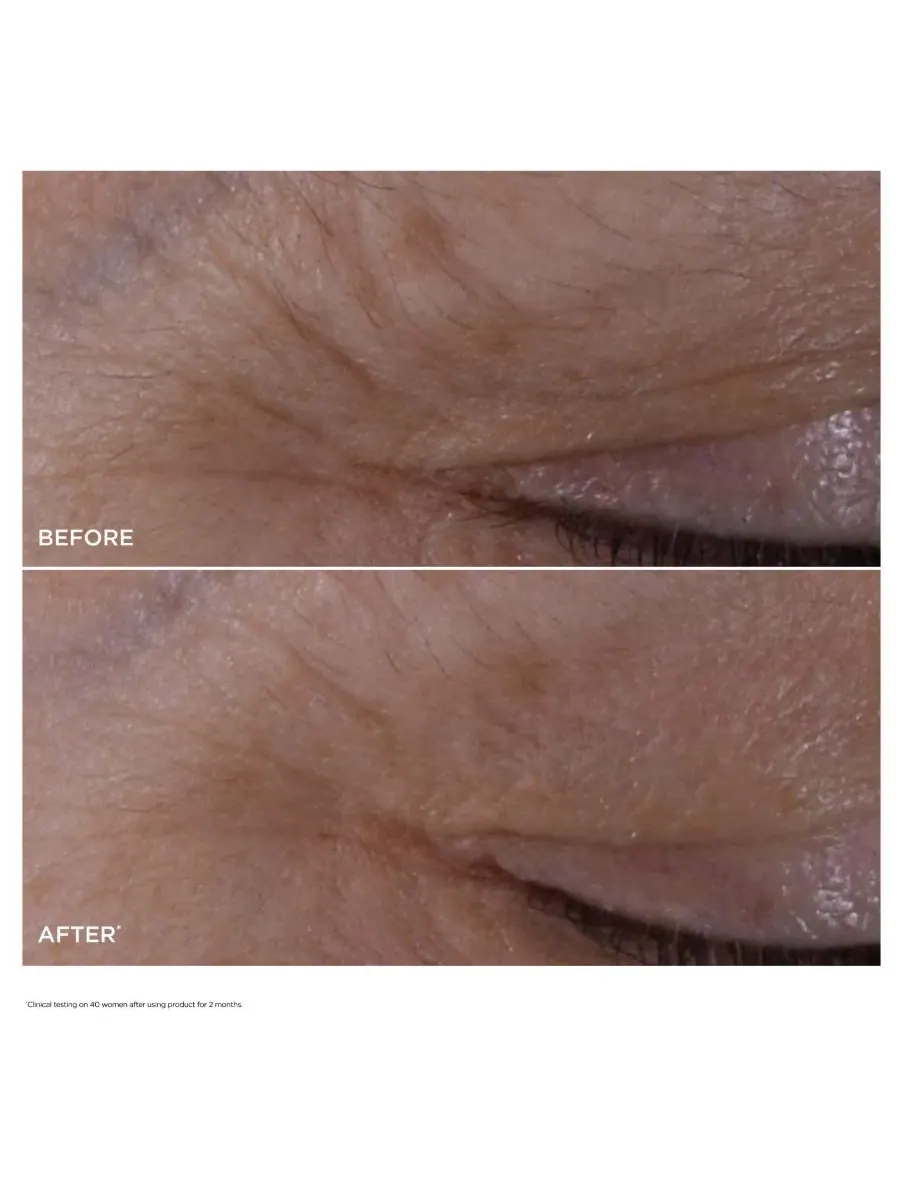 Сыворотка для контура глаз Clarins Double Serum Eye Brightening & Depuffing, 20 мл — изображение 4 из 14