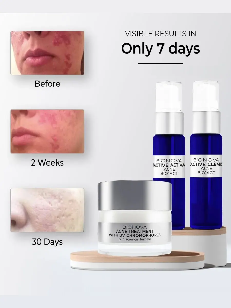 Bionova Коллекция средств от прыщей Acne Discovery с УФ-хромофорами — изображение 4 из 8