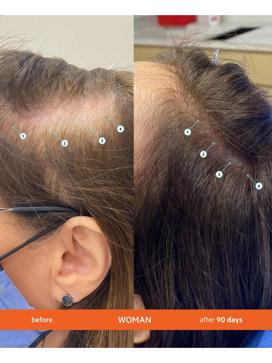 Сменный блок кондиционера для придания густоты волосам Revita High-Performance Hair Density — изображение 7 из 8
