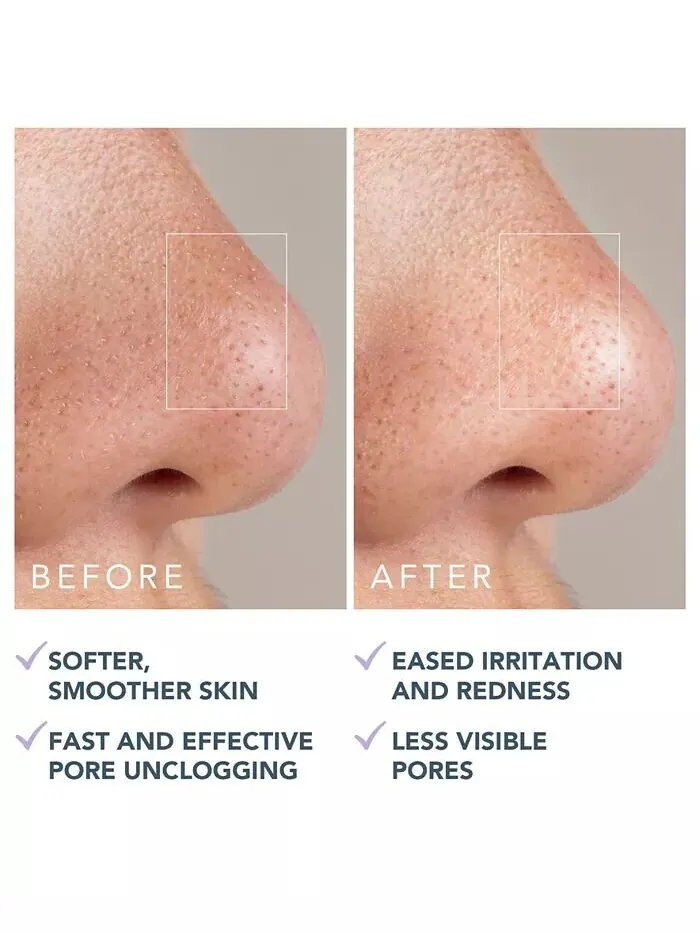 Маска для лица Foreo — От черных точек Kiwi Active Pore, 100 г — изображение 3 из 5