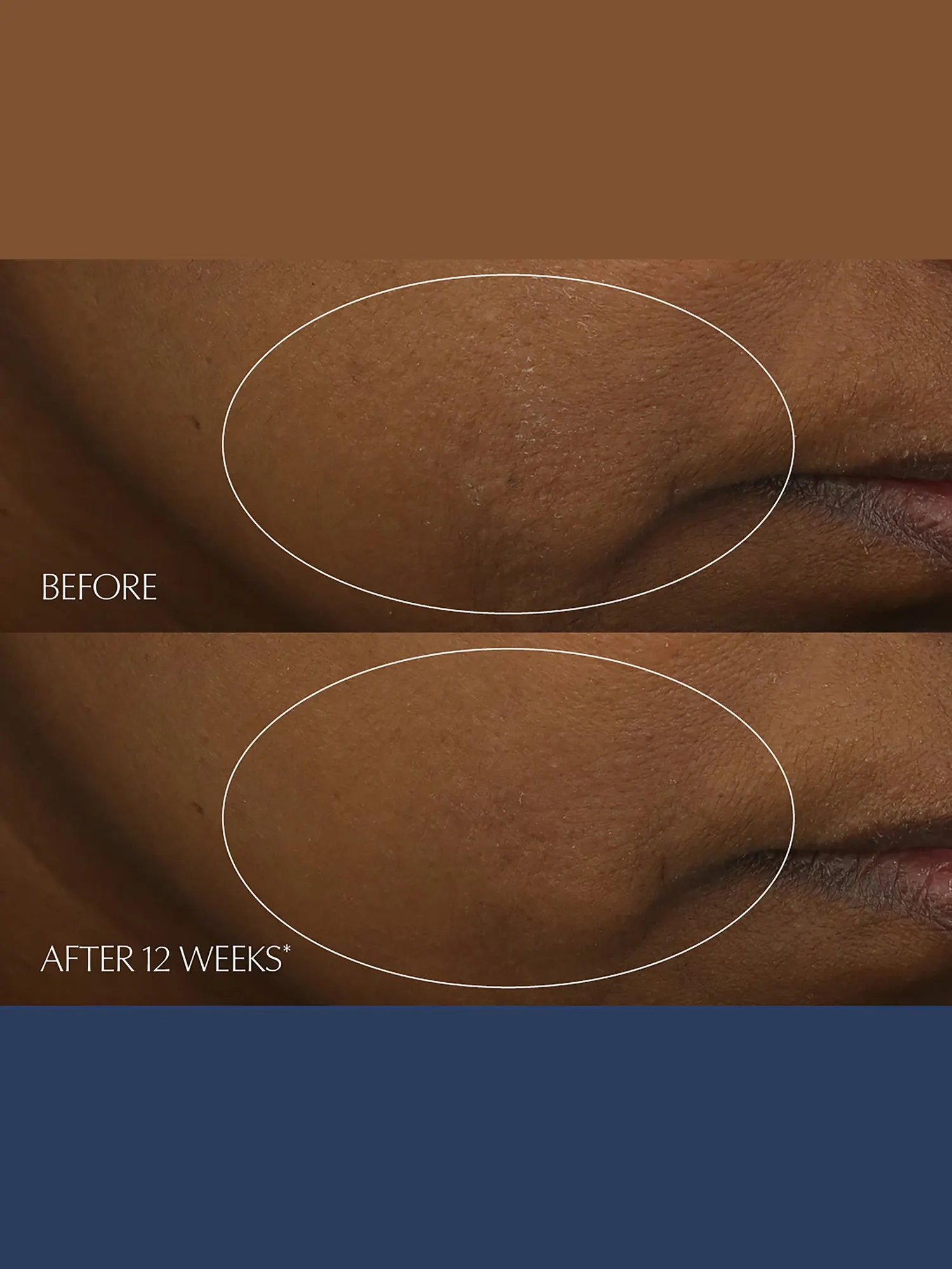 Сыворотка для лица Estée Lauder Advanced Night Repair Multi-Recovery, 7 мл — изображение 5 из 6