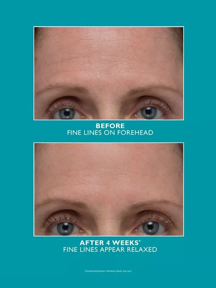 Сыворотка Peter Thomas Roth — Peptide Skinjection, усиленная для устранения морщин — изображение 4 из 5
