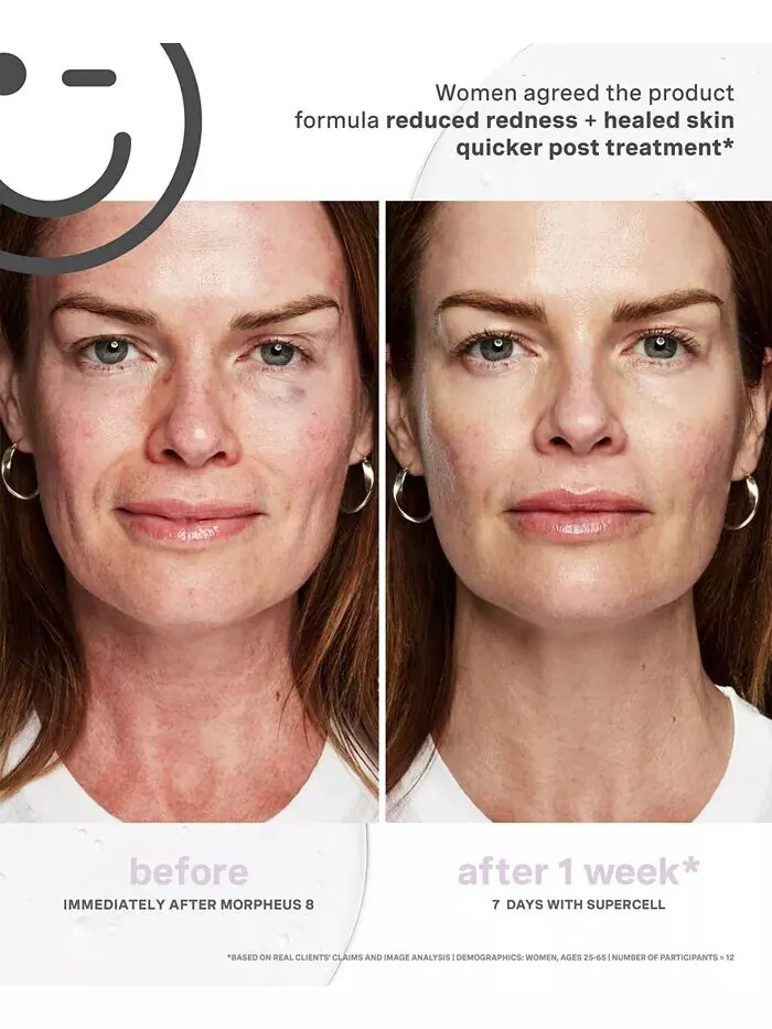 Бустер Kate Somerville — Ceuticals Super для омоложения клеток — изображение 6 из 8