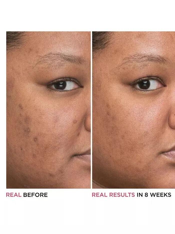 Сыворотка It Cosmetics — Bye Bye Dark Spots % концентрированная для дермы с ниацинамидом — изображение 2 из 8
