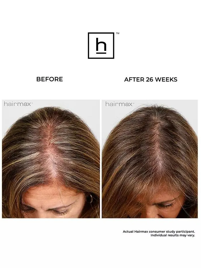 Лазерная расческа Hairmax Ultima 12 для роста волос — изображение 6 из 7