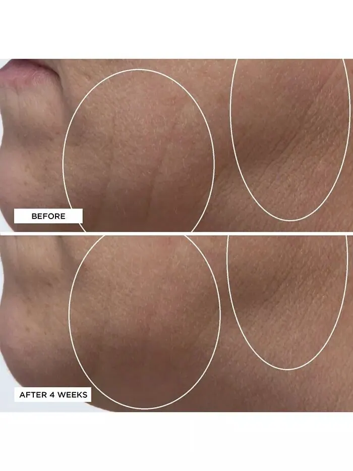 Сыворотка Perricone Md — Высокоэффективный интенсивный увлажняющий с гиалуроновой кислотой — изображение 6 из 7