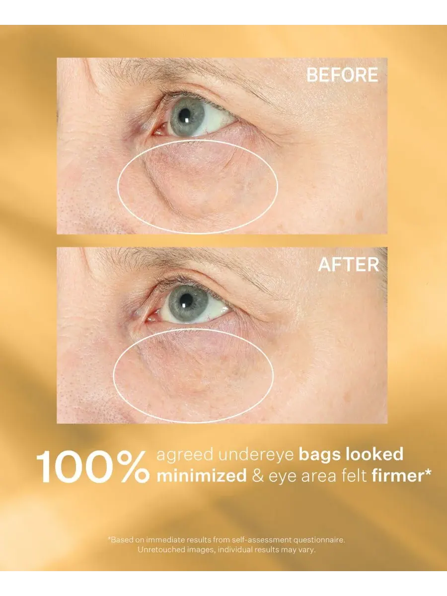 Крем для лица StriVectin — Hyperlift Eye Instant Eye Fix — изображение 6 из 7