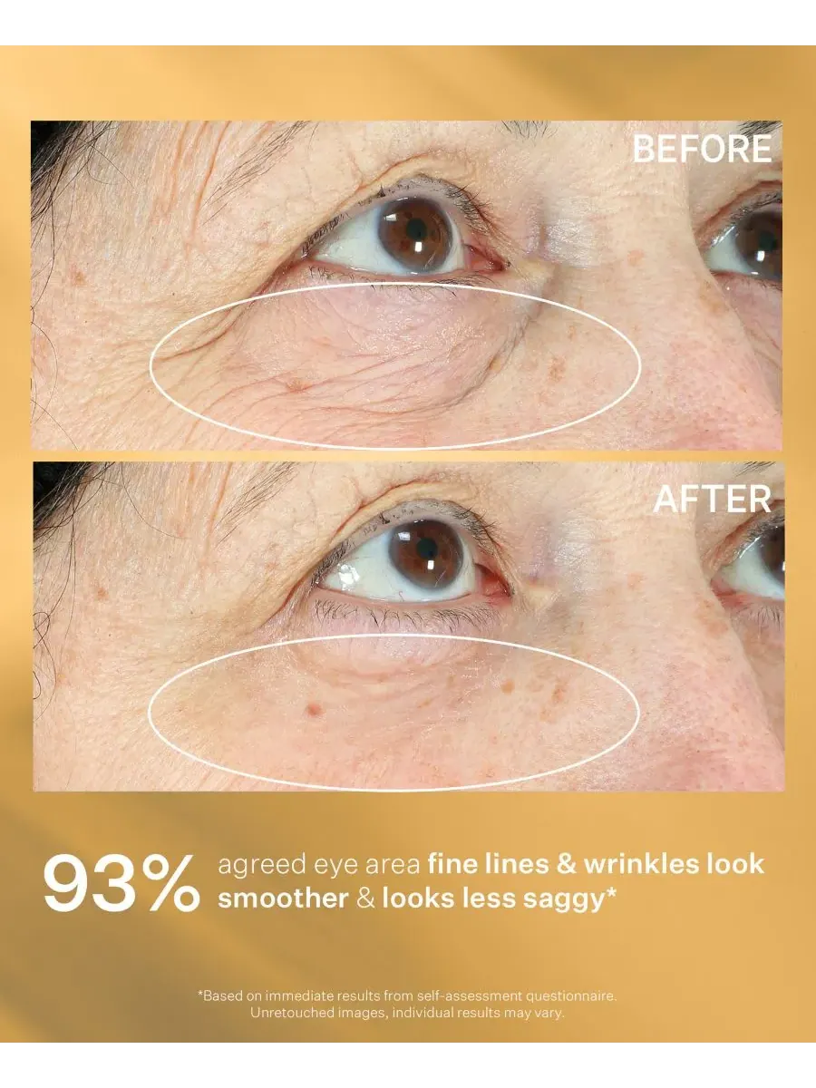 Крем для лица StriVectin — Hyperlift Eye Instant Eye Fix — изображение 7 из 7