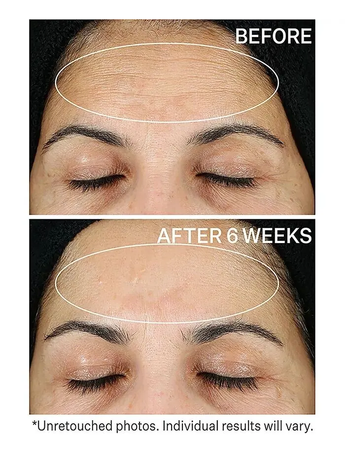 Сыворотка StriVectin — Super C Retinol Осветляющая и корректирующая с витамином С — изображение 3 из 5