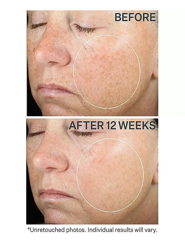 Сыворотка StriVectin — Super C Retinol Осветляющая и корректирующая с витамином С — изображение 5 из 5
