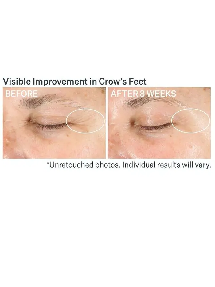 Мультикорректирующий крем для век Advanced Retinol Strivectin — изображение 3 из 9
