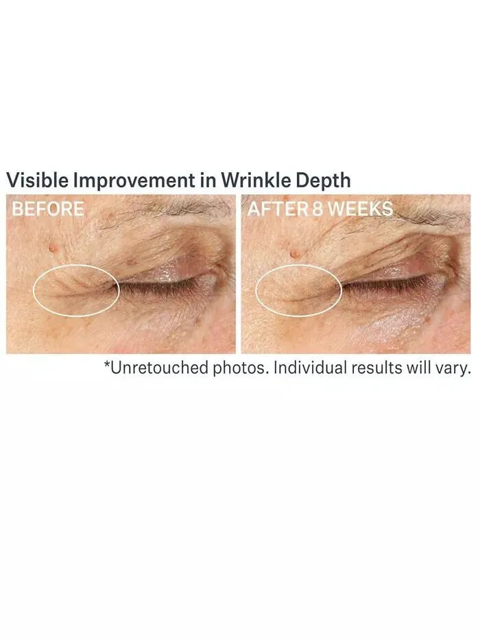 Мультикорректирующий крем для век Advanced Retinol Strivectin — изображение 4 из 9