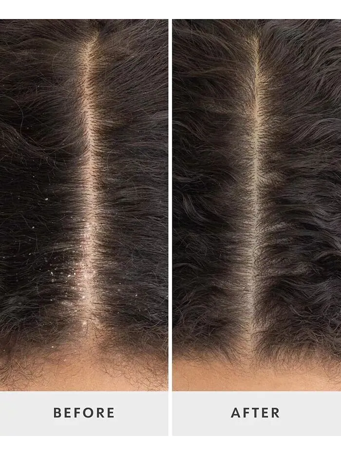 Очищающее средство для балансировки кожи головы перед шампунем Crown Tonic Drybar — изображение 9 из 12