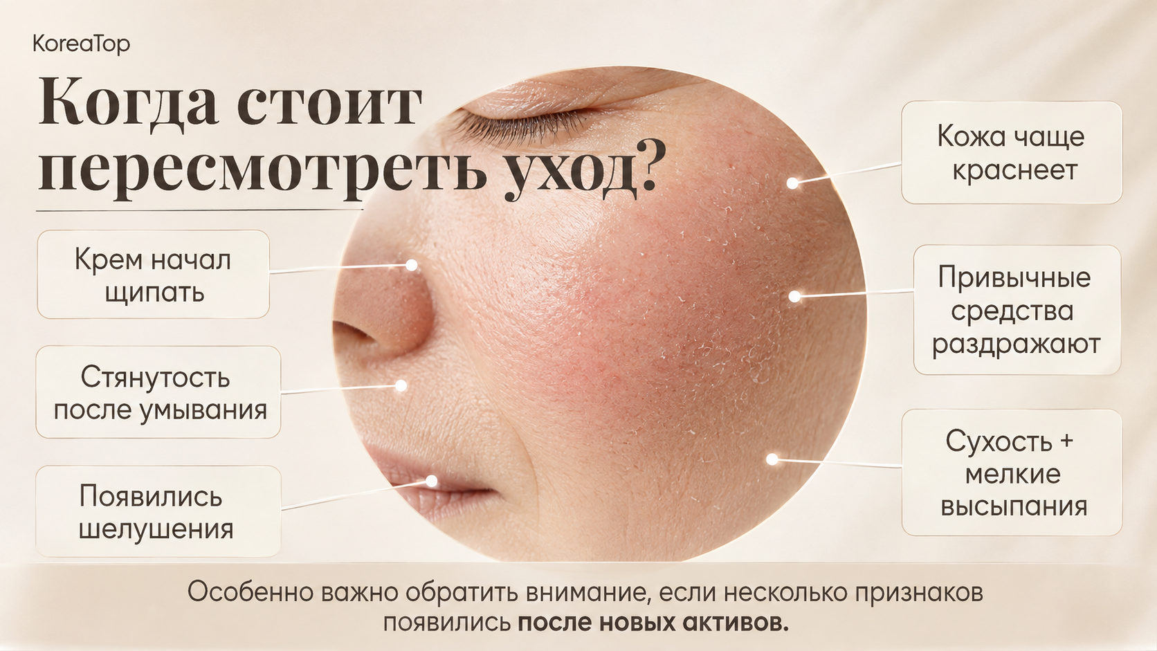 Инфографика с признаками чувствительной кожи после слишком активного ухода: крем щиплет, появляется стянутость после умывания, шелушение, покраснение, раздражение от привычной косметики и сочетание сухости с мелкими высыпаниями.